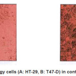 Fig. 11: morphology cells (A: HT-29, B: T47-D) in contain HMND (0/001M)