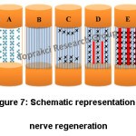 Figure 7: Schematic representation of nerve regeneration